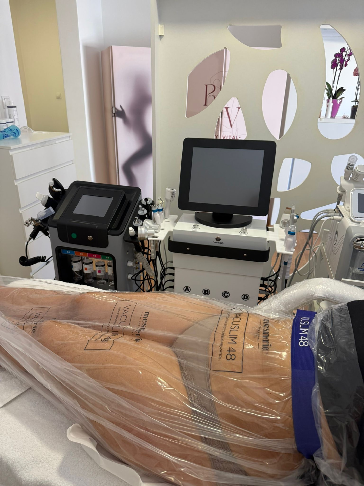 Tretman oblikovanja tela u toku – Vacu Slim 48 u Body Vital salonu